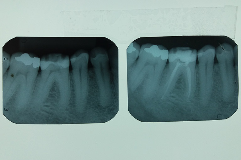 Endodontia