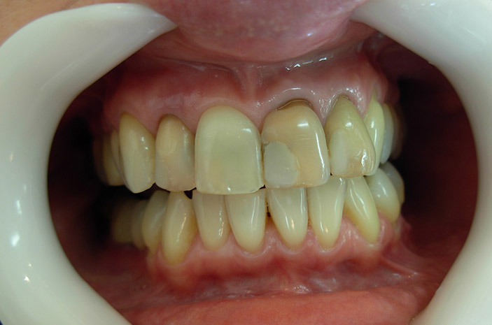Estética dental